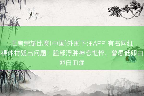 王者荣耀比赛(中国)外围下注APP 有名网红董赤裸体材疑出问题!脸部浮肿神态憔悴,曾患低卵白血症